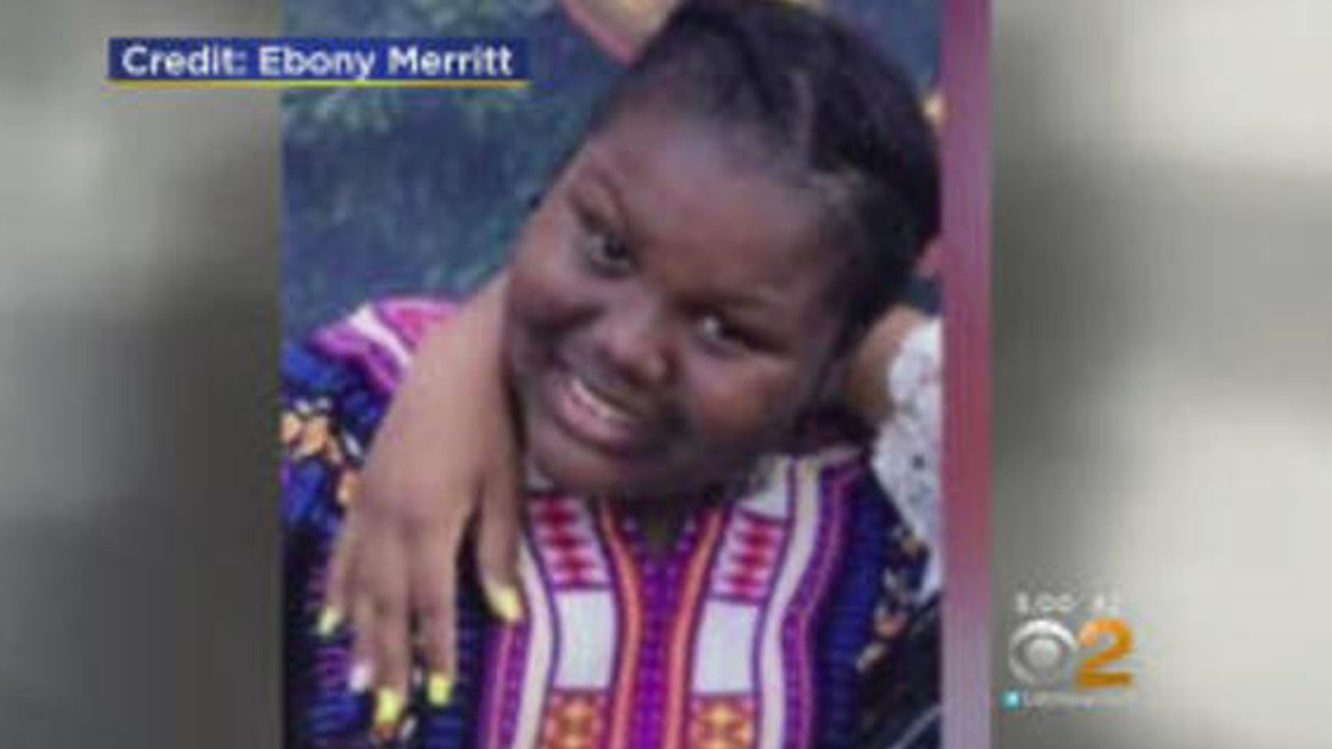 Girl's Face Severely Burned When Another Girl Pours Boiling Water on